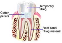 Filling the canals