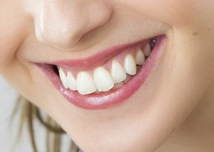 smile