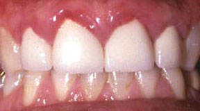 Crowns Gallery Case 8 