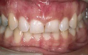 Periodontal Gallery 