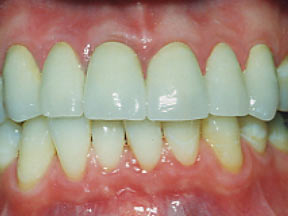Crowns Gallery Case 3 