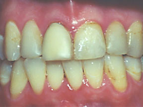 Crowns Gallery Case 3 
