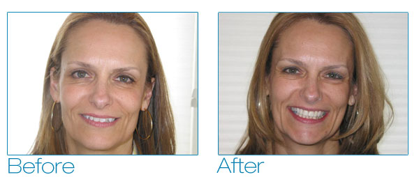 Debra before and after #1