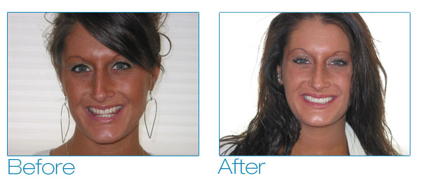 Kate before and after #1