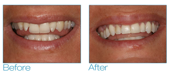Kate before and after #2