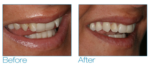 Kate before and after #3
