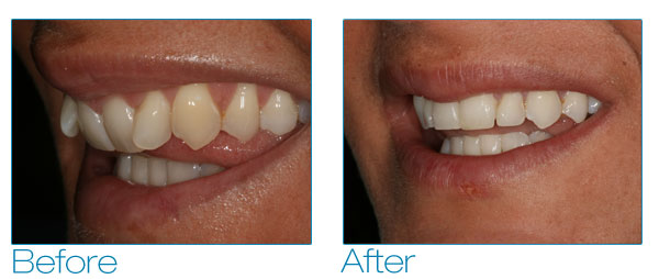 Kate before and after #4