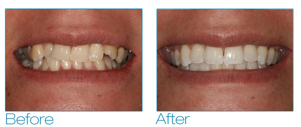 Melissa before and after #2
