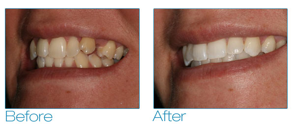 Melissa before and after #4