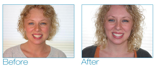 Mindy before and after #1