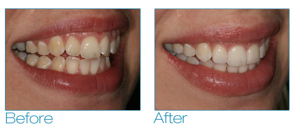 Mindy before and after #3
