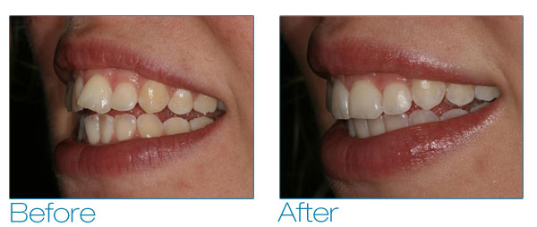 Mindy before and after #4