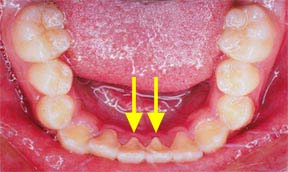Orthodontic Gallery Case 10 